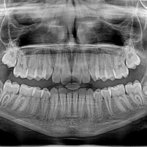 xray x-ray, x-ray, photo-2764828.jpg